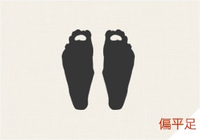 偏平足